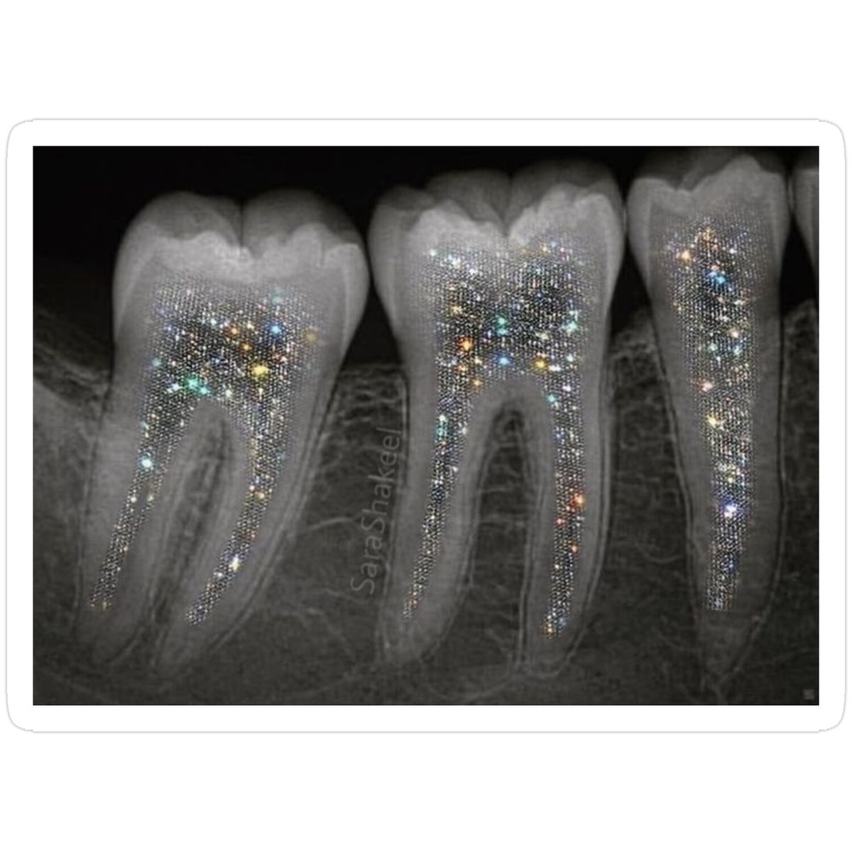 Understanding Regenerative Healing in Dental Care